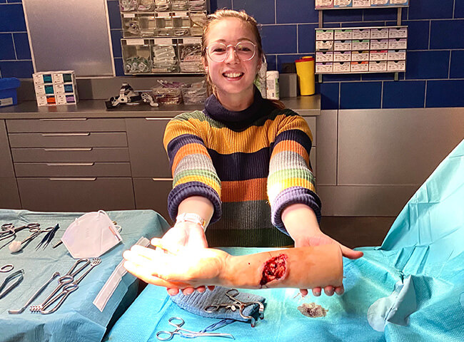 Die Medizinstudentin Annika mit einer künstlichen Hand am Set einer Krankenhausserie.